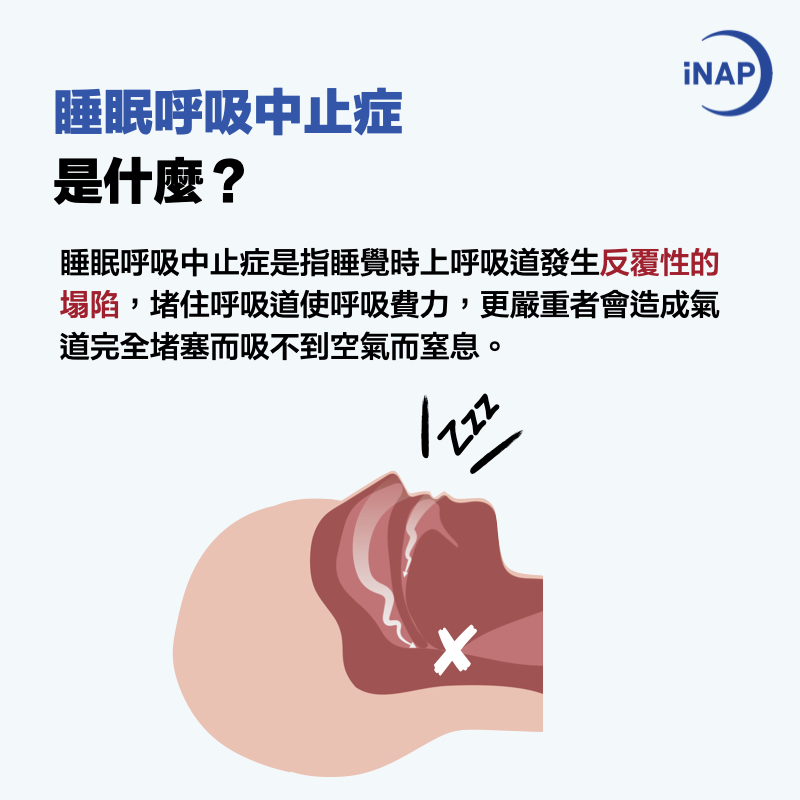 睡眠呼吸中止症 成因