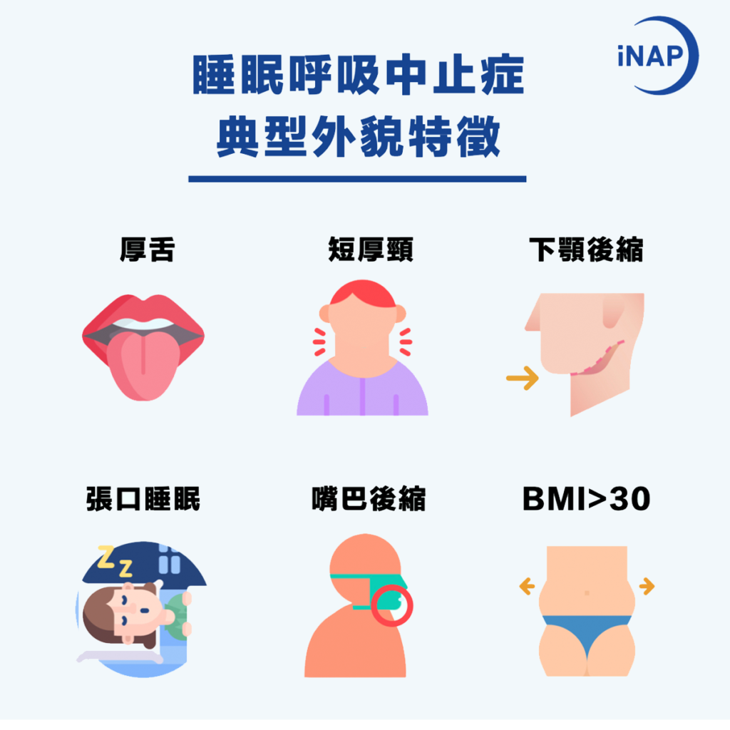  睡眠呼吸中止症 外貌特徵