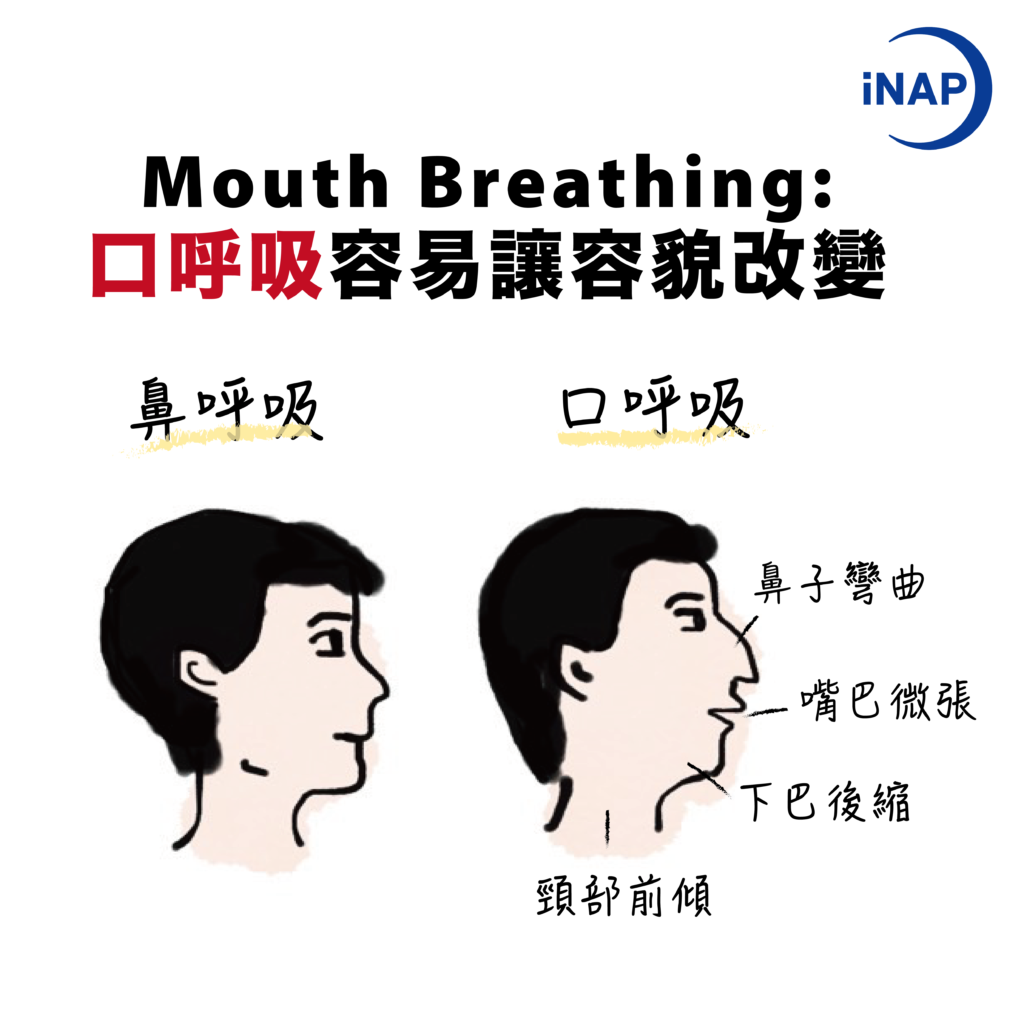 口呼吸改變容貌

