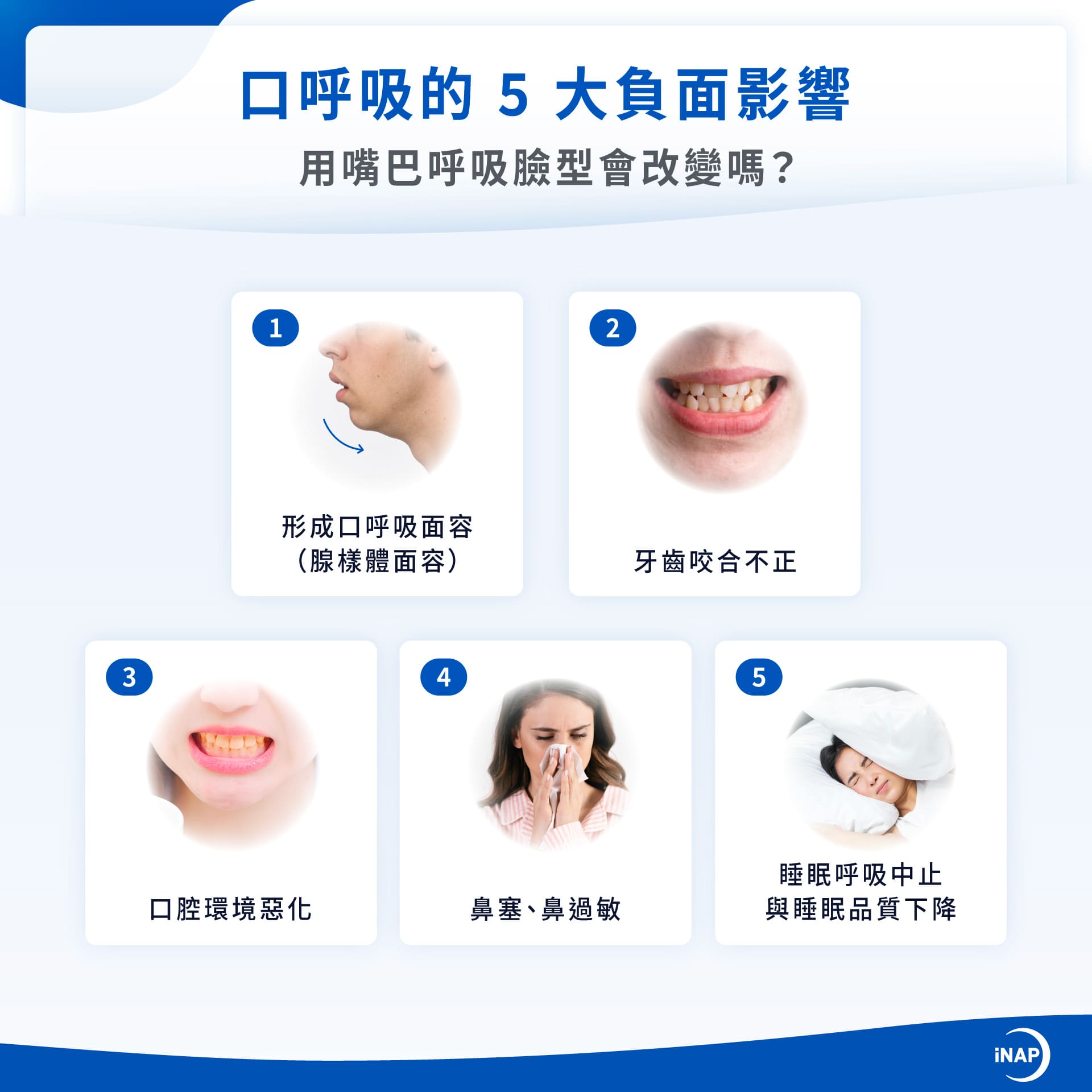 口呼吸的 5 大負面影響：口呼吸面容（腺樣體面容）、牙齒咬合不正、口腔環境惡化、鼻塞、鼻過敏、睡眠呼吸中止與睡眠品質下降
